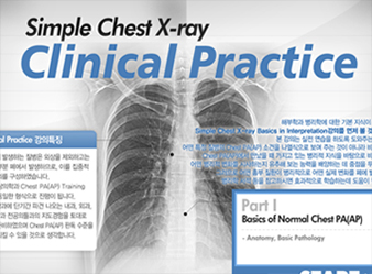 Simple Chest X-ray : Clinical Practice
